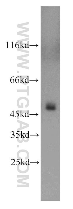 UQCRC2 Rabbit anti-Human, Mouse, Rat, Polyclonal, Proteintech:Antibodies:Primary