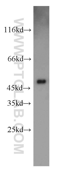 UQCRC2 Rabbit anti-Human, Mouse, Rat, Polyclonal, Proteintech:Antibodies:Primary
