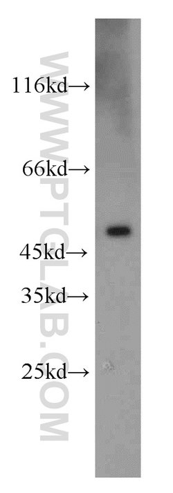 UQCRC2 Rabbit anti-Human, Mouse, Rat, Polyclonal, Proteintech:Antibodies:Primary