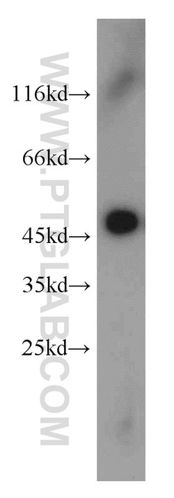 UQCRC2 Rabbit anti-Human, Mouse, Rat, Polyclonal, Proteintech:Antibodies:Primary