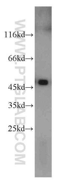 UQCRC2 Rabbit anti-Human, Mouse, Rat, Polyclonal, Proteintech:Antibodies:Primary
