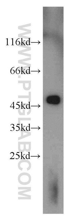 UQCRC2 Rabbit anti-Human, Mouse, Rat, Polyclonal, Proteintech:Antibodies:Primary