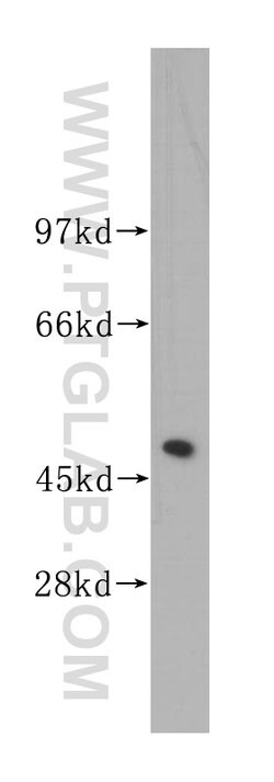UQCRC2 Rabbit anti-Human, Mouse, Rat, Polyclonal, Proteintech:Antibodies:Primary