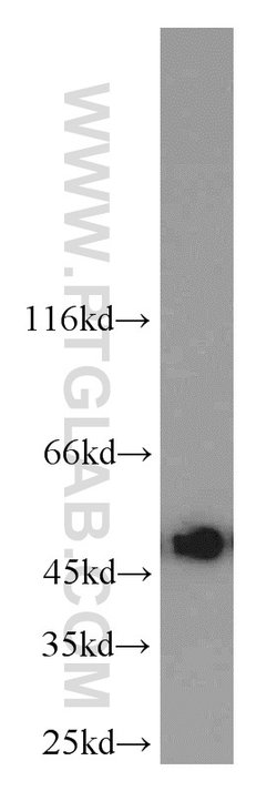 UQCRC2 Rabbit anti-Human, Mouse, Rat, Polyclonal, Proteintech:Antibodies:Primary
