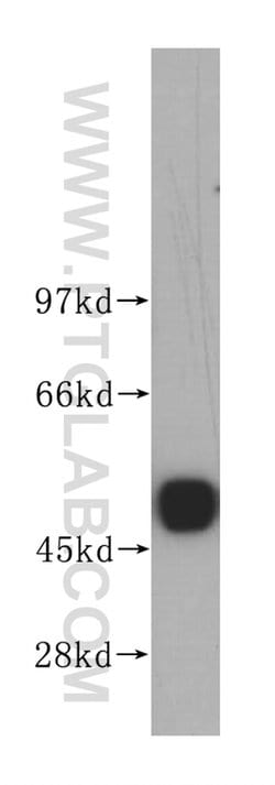 UQCRC2 Rabbit anti-Human, Mouse, Rat, Polyclonal, Proteintech:Antibodies:Primary