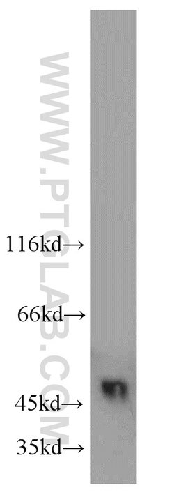 UQCRC2 Rabbit anti-Human, Mouse, Rat, Polyclonal, Proteintech:Antibodies:Primary