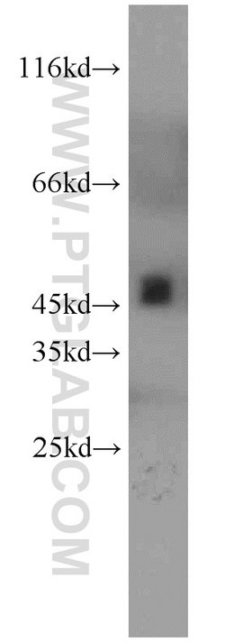 UQCRC2 Rabbit anti-Human, Mouse, Rat, Polyclonal, Proteintech:Antibodies:Primary