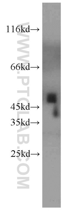 UQCRC2 Rabbit anti-Human, Mouse, Rat, Polyclonal, Proteintech:Antibodies:Primary