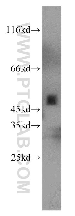 Proteintech UQCRC2 Rabbit anti-Human, Mouse, Rat, Polyclonal, Proteintech