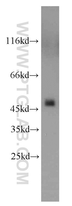 UQCRC2 Rabbit anti-Human, Mouse, Rat, Polyclonal, Proteintech:Antibodies:Primary