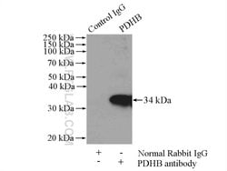 PDHB Rabbit anti-Human, Mouse, Rat, Polyclonal, Proteintech 150 &mu;L;