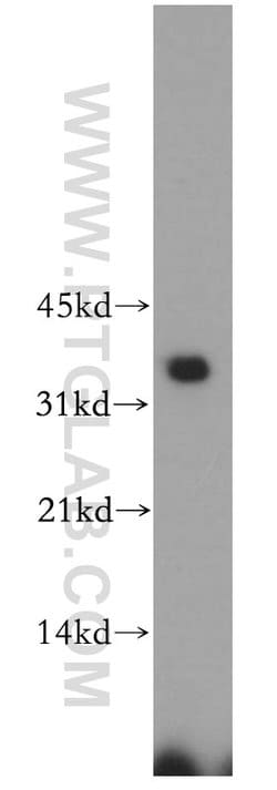 PDHB Rabbit anti-Human, Mouse, Rat, Polyclonal, Proteintech 150 &mu;L;
