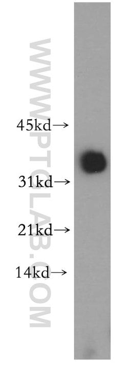 PDHB Rabbit anti-Human, Mouse, Rat, Polyclonal, Proteintech 150 &mu;L;
