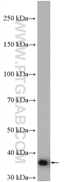 PDHB Rabbit anti-Human, Mouse, Rat, Polyclonal, Proteintech 150 &mu;L;