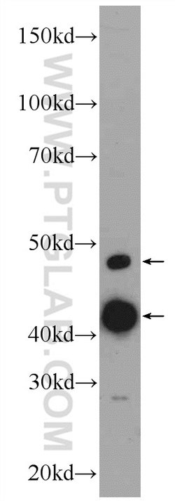 CLP1 Rabbit anti-Human, Mouse, Polyclonal, Proteintech 150 &mu;L; Unconjugated:Antibodies,