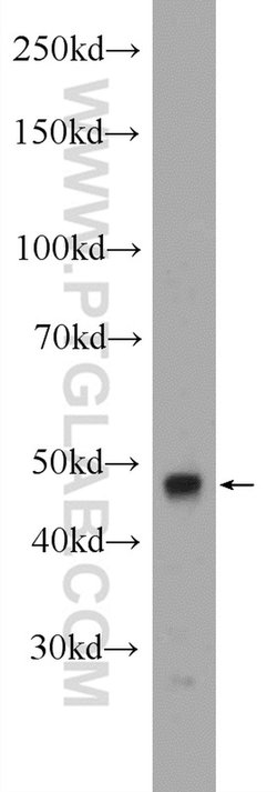 CLP1 Rabbit anti-Human, Mouse, Polyclonal, Proteintech 150 &mu;L; Unconjugated:Antibodies,