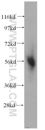 Thumbnail_CORO1C Rabbit anti-Human, Mouse, Rat, Polyclonal, Proteintech 150 &mu;L;