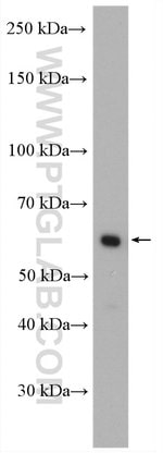 Thumbnail_CORO1C Rabbit anti-Human, Mouse, Rat, Polyclonal, Proteintech 150 &mu;L;