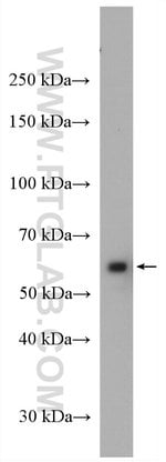 Thumbnail_CORO1C Rabbit anti-Human, Mouse, Rat, Polyclonal, Proteintech 150 &mu;L;