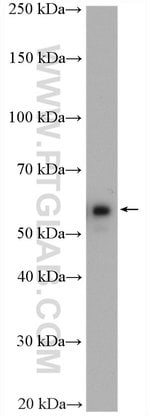 Thumbnail_CORO1C Rabbit anti-Human, Mouse, Rat, Polyclonal, Proteintech 150 &mu;L;