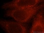 Thumbnail_CORO1C Rabbit anti-Human, Mouse, Rat, Polyclonal, Proteintech 150 &mu;L;
