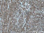 Thumbnail_CORO1C Rabbit anti-Human, Mouse, Rat, Polyclonal, Proteintech 150 &mu;L;