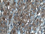 Thumbnail_CORO1C Rabbit anti-Human, Mouse, Rat, Polyclonal, Proteintech 150 &mu;L;