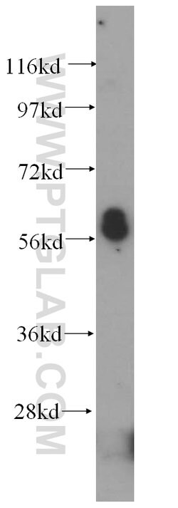 OSBPL2 Rabbit anti-Human, Mouse, Polyclonal, Proteintech 150 &mu;L | Buy Online | Proteintech Group Inc | Fisher Scientific
