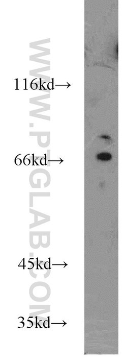 AARE Rabbit anti-Human, Mouse, Rat, Polyclonal, Proteintech:Anticorps:Anticorps