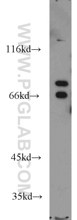 AARE Rabbit anti-Human, Mouse, Rat, Polyclonal, Proteintech:Anticorps:Anticorps