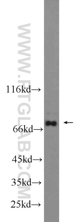 AARE Rabbit anti-Human, Mouse, Rat, Polyclonal, Proteintech:Anticorps:Anticorps