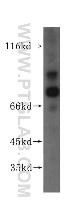 AARE Rabbit anti-Human, Mouse, Rat, Polyclonal, Proteintech:Anticorps:Anticorps