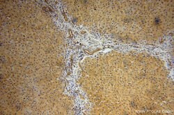 AARE Rabbit anti-Human, Mouse, Rat, Polyclonal, Proteintech:Anticorps:Anticorps