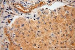 AARE Rabbit anti-Human, Mouse, Rat, Polyclonal, Proteintech:Anticorps:Anticorps