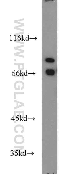 AARE Rabbit anti-Human, Mouse, Rat, Polyclonal, Proteintech:Anticorps:Anticorps