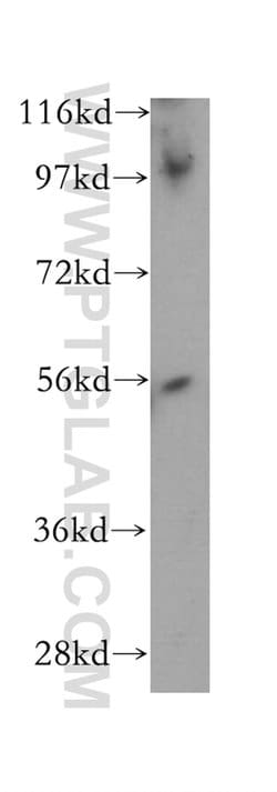PWP1 Rabbit anti-Human, Mouse, Rat, Polyclonal, Proteintech 20 &mu;L; Unconjugated:Anticuerpos