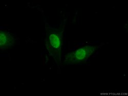 FEN1 Rabbit anti-Human, Mouse, Rat, Polyclonal, Proteintech:Antibodies:Primary