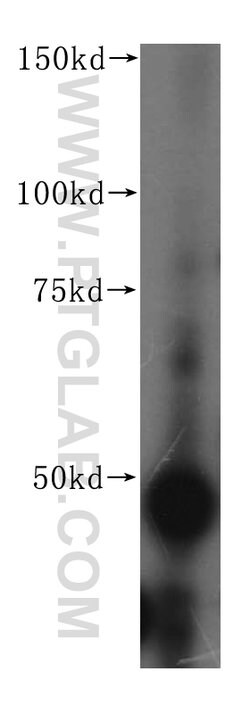 FEN1 Rabbit anti-Human, Mouse, Rat, Polyclonal, Proteintech:Antibodies:Primary