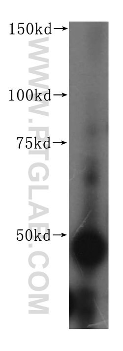 FEN1 Rabbit anti-Human, Mouse, Rat, Polyclonal, Proteintech 20 &mu;L; Unconjugated 