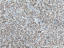 HNRNPH1 Rabbit anti-Human, Mouse, Rat, Polyclonal, Proteintech 150 &mu;L;