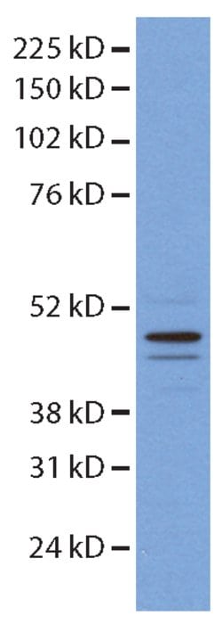 HNRNPH1 Rabbit anti-Human, Mouse, Rat, Polyclonal, Proteintech 150 &mu;L;