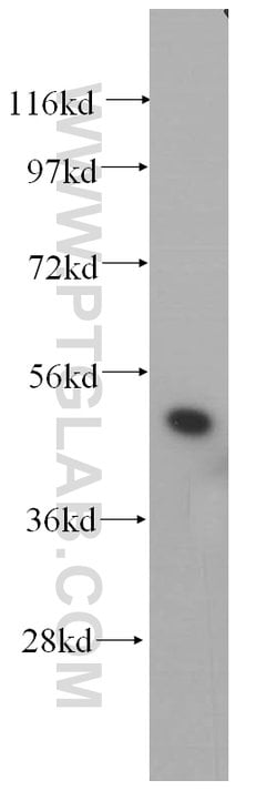 HNRNPH1 Rabbit anti-Human, Mouse, Rat, Polyclonal, Proteintech 150 &mu;L;