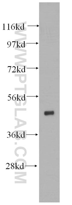 HNRNPH1 Rabbit anti-Human, Mouse, Rat, Polyclonal, Proteintech 150 &mu;L;