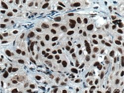 HNRNPH1 Rabbit anti-Human, Mouse, Rat, Polyclonal, Proteintech 150 &mu;L;