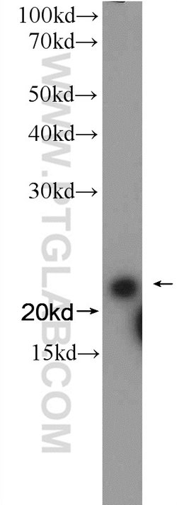 SEC22B Rabbit anti-Human, Mouse, Rat, Polyclonal, Proteintech:Antibodies:Primary