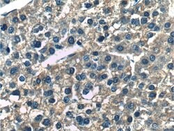 ERLIN2 Rabbit anti-Human, Mouse, Rat, Polyclonal, Proteintech 150 &mu;L;