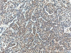 ERLIN2 Rabbit anti-Human, Mouse, Rat, Polyclonal, Proteintech 150 &mu;L;