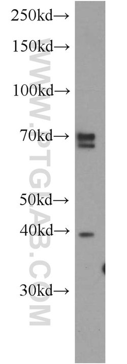 ERLIN2 Rabbit anti-Human, Mouse, Rat, Polyclonal, Proteintech 150 &mu;L;