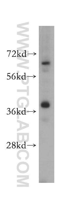 ERLIN2 Rabbit anti-Human, Mouse, Rat, Polyclonal, Proteintech 150 &mu;L;