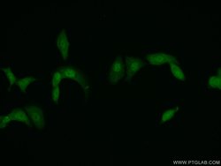 PSMD11 Rabbit anti-Human, Mouse, Rat, Polyclonal, Proteintech 150 &mu;L;